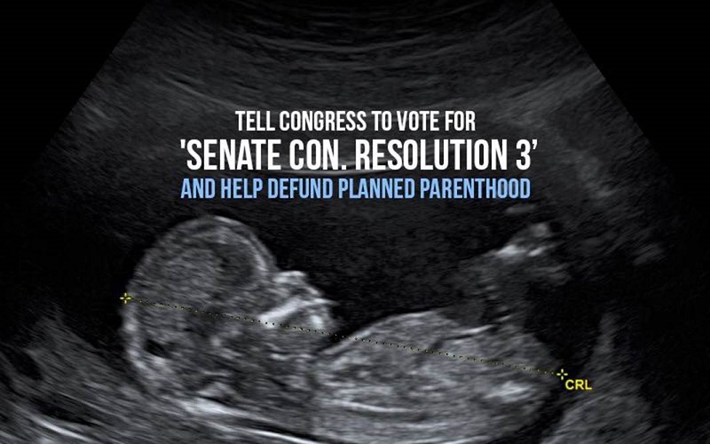 End taxpayer funding of Planned Parenthood