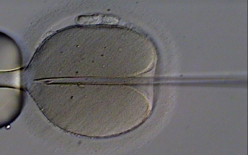 What Do Late-Term Abortions and IVF Have in Common?