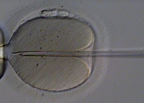 What Do Late-Term Abortions and IVF Have in Common?