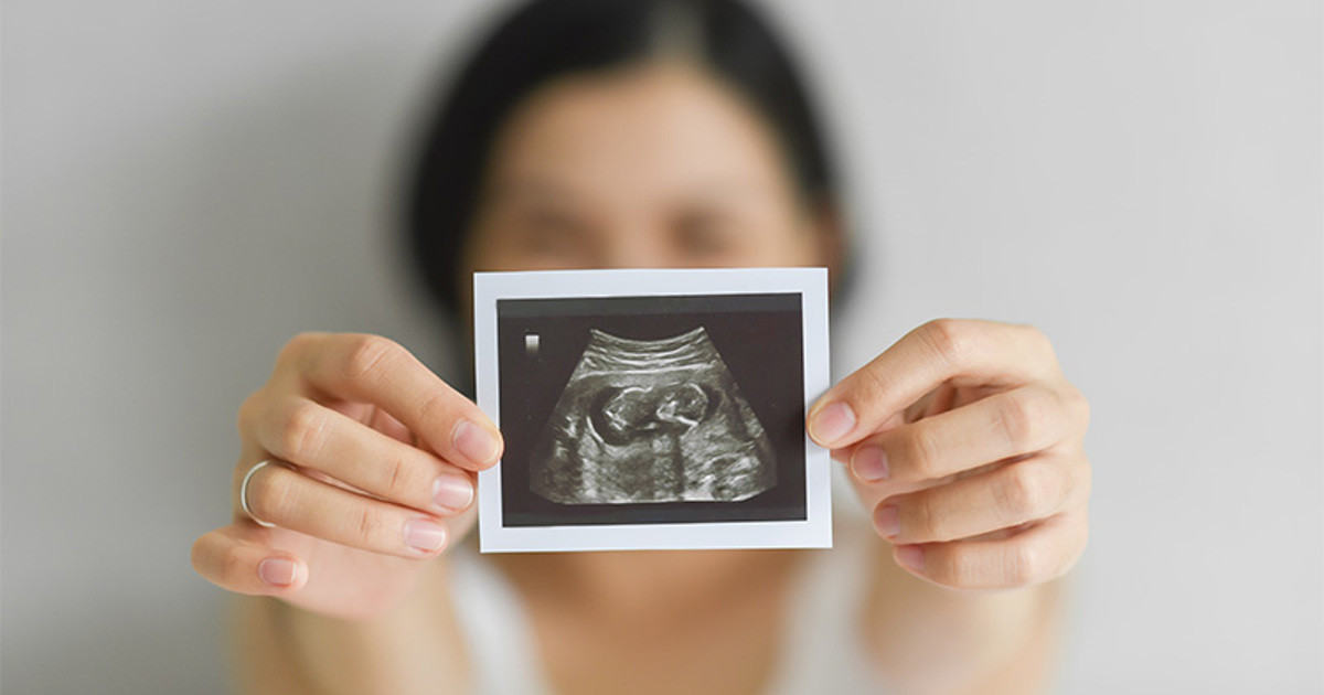 AFA - A Sonogram Changes Everything