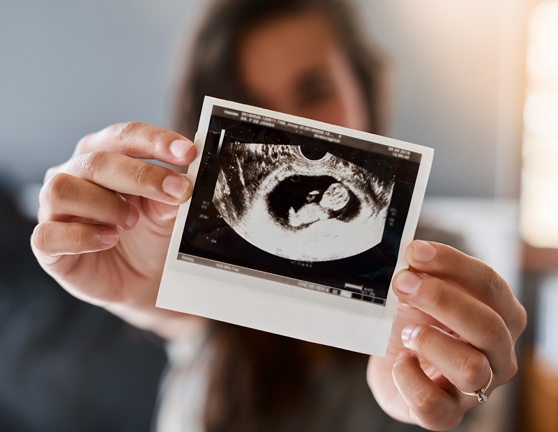 Great Pro-Life News From the Supreme Court