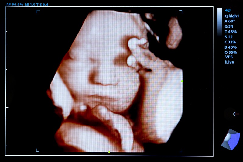 Abortion Is a Spiritual Battle