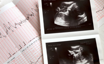 The Power of a Heartbeat