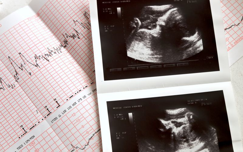 The Power of a Heartbeat