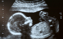 Considering Life and Words