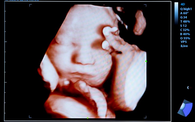 Gov. Newsom:  Babies in Womb Not Neighbors